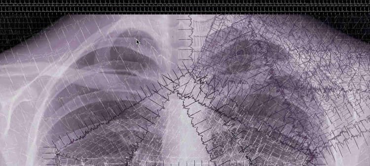 The Intersect: Art in Tech and Tech in Art